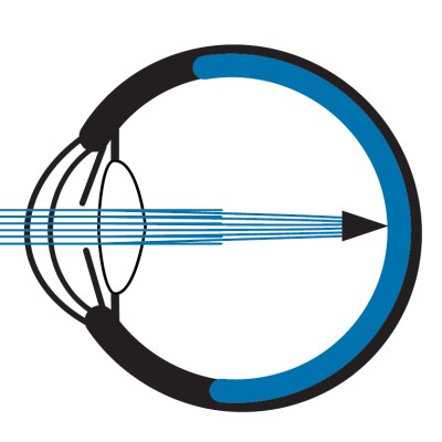 Ophthalmic Technician